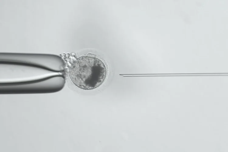 Tecnica-opu-icsi