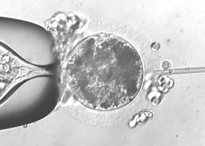 Seguimiento de la gestación de embriones con ICSI